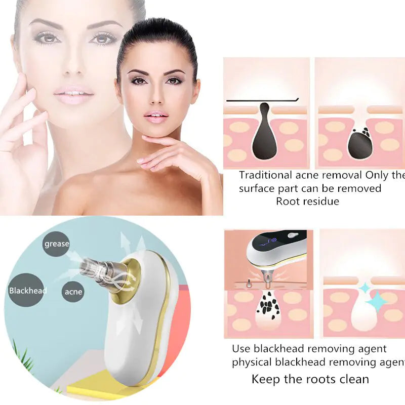 Vacuum Suction Clean Skin Care Device